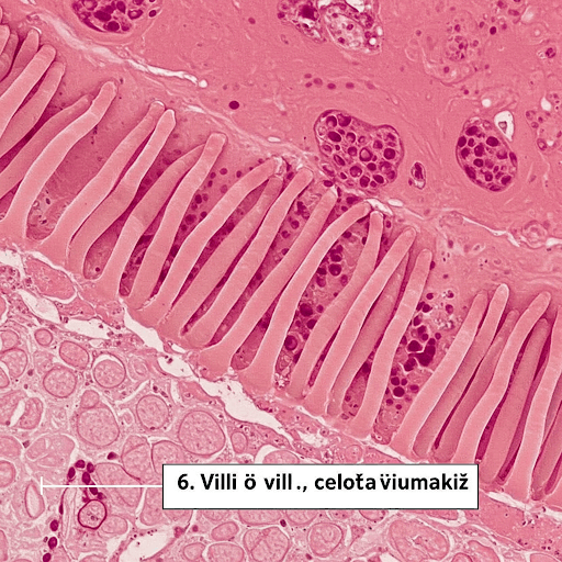 Celiakija: nematomas priešas lėkštėje