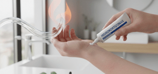 Hidrokortizonas be baimės: kaip teisingai valdyti odos ir kūno gaisrus